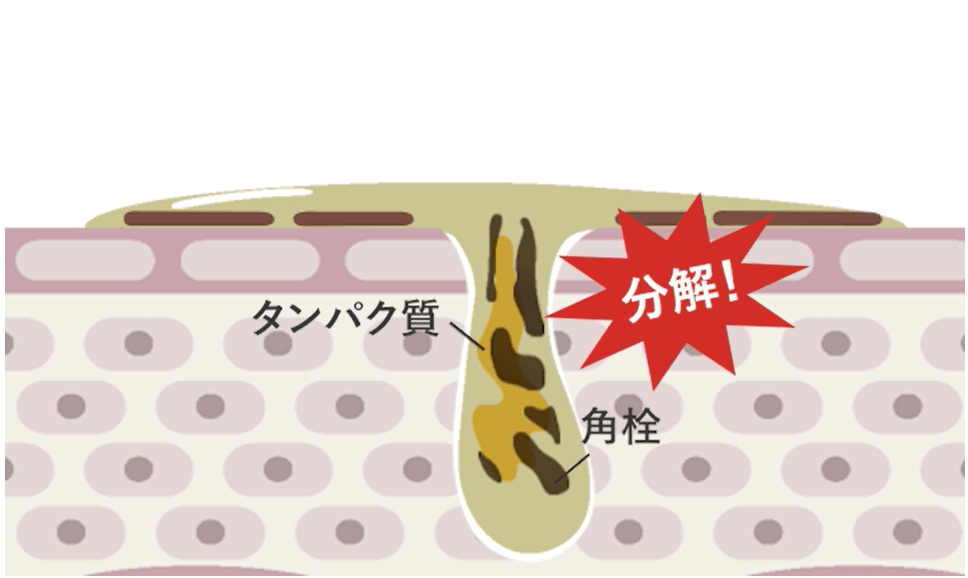 ピリモバブルジェルクレンジングの分解酵素が角栓やタンパク質を分解している様子