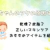 赤ちゃんのフケの原因とは？