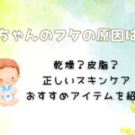 赤ちゃんのフケの原因とは？